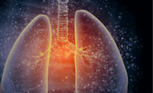 Sharp Rise in Respiratory Infections: Sindh Reports 248 Cases, Health Experts Urge Precautions