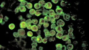 Tragic First Fatality from Brain-Eating Amoeba Reported in Karachi